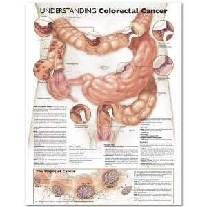  Understanding Colorectal Cancer Anatomical Chart 