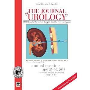 of Urology(r) Official Journal of the American Urological Association 