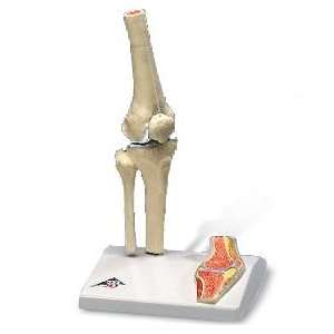  Mini Knee Joint with Cross Section